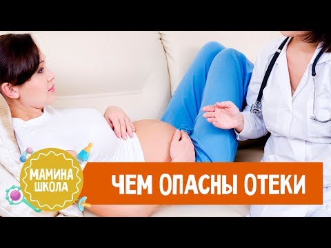 Отеки при беременности. Что делать?