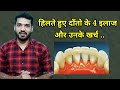 हिलते हुए दाँतो के 4 इलाज और खर्च ! Tooth mobility treatment and cost |