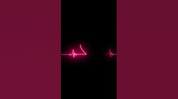 Fault  Tolerance  in quatum computing