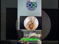 🤯 Wax Removal So Good You’ll Replay It! #earwax #viral #doctor