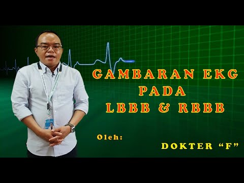 Video: Blok Cabang Bundel Kanan: Gejala, Punca, Diagnosis, Rawatan