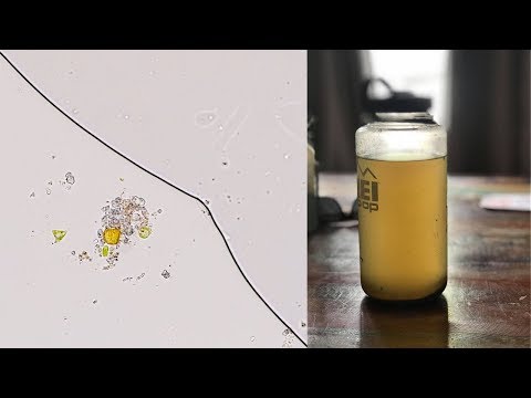 Vignette de la vidéo MSR Guardian Review with Microscope Footage in 4k