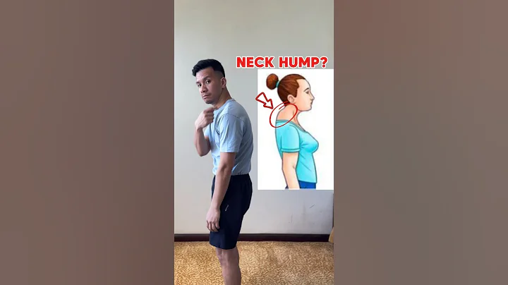 Learn how to fix NECK HUMP at home!! 🤩🤩🤩 #kyphosis #neckhump