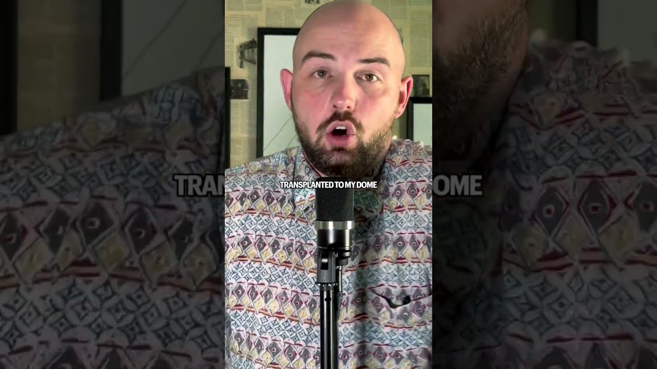 balds are more funner