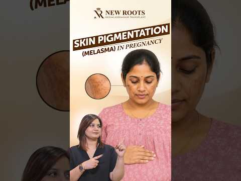 The Truth About Pregnancy Pigmentation | Melasma 😱 #pregnancy #pigmentation #shorts