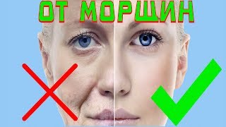 Упражнения от морщин / Как убрать морщины дома / Носогубные складки  / Гусиные лапки вокруг глаз