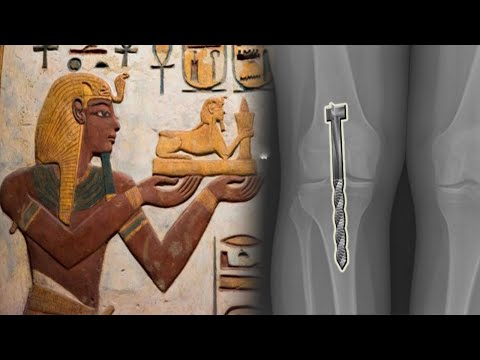 Video: Medicine Of Ancient Egypt - Alternative View