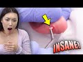 Her Earring Was STUCK For 13 Years!! *INSANE*