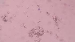 WBCs stained by New methylene blue  |supravital stain