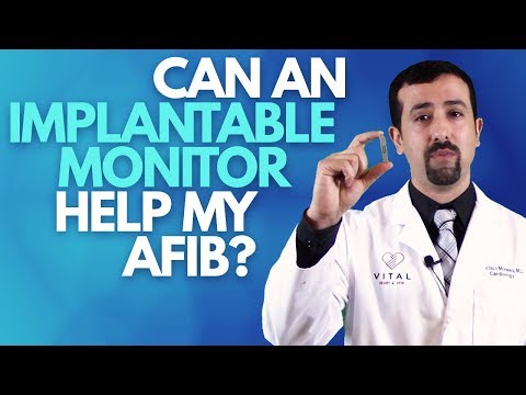 Can an Implantable Monitor Help my AFib? - Dr Afib