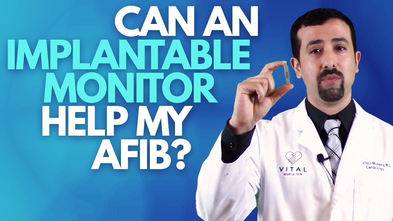 Can an Implantable Monitor Help my AFib? Dr Afib YouTube