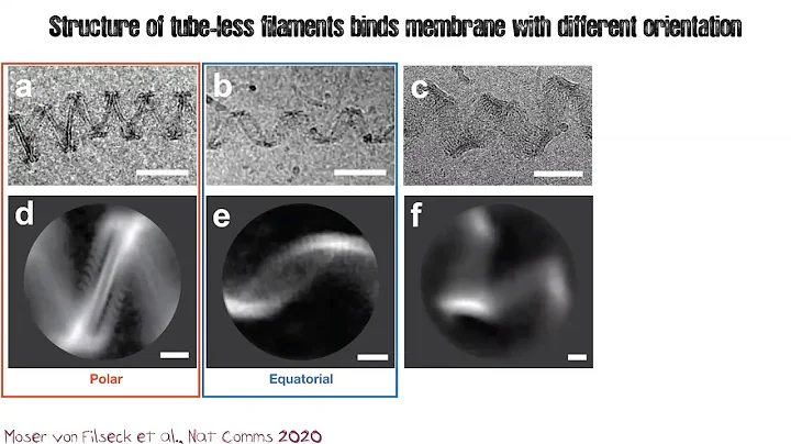 The unique ESCRT-III mechanics that drives membrane remodelling - Oct 19th 2020 - DayDayNews