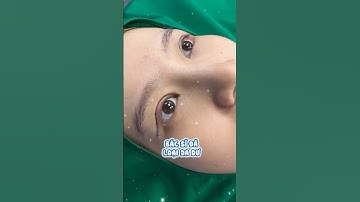 Cắt mí "không ai giống ai" nha mọi người ! | Dr Hùng Thanh