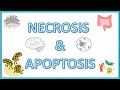 Cell Death : Necrosis & Apoptosis - Types, Morphology, Causes, Mechanism & Clinical Significance