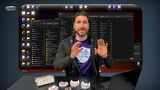 How to install exocad libraries for Scan Ladder