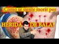 ¿Cómo se siente M0RlR POR HERlDA DE BALA?