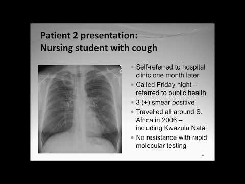 Video: Kas 2020 m. tuberkuliozės gairės?