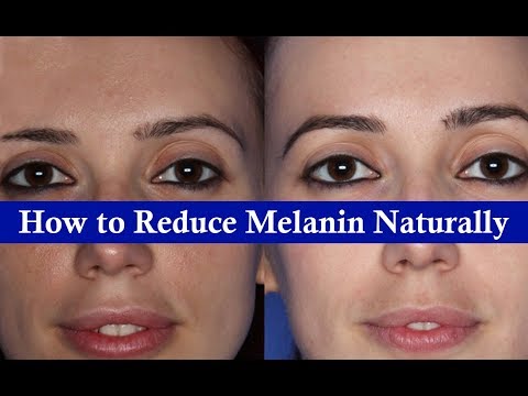 How to reduce melanin in skin naturally | How to reduce melanin in face | Get fair skin