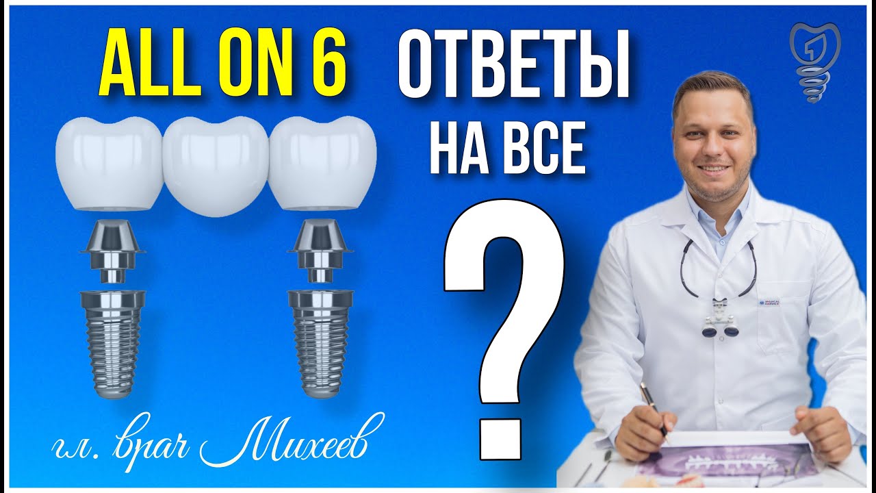 Всё что вы хотели знать об All on 6. Имплантация зубов.