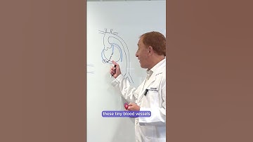 Chronic Total Occlusion (CTO)