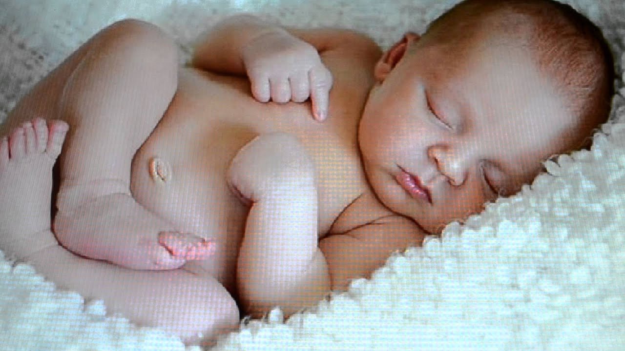 Лечение опрелости ребёнка - YouTube