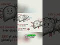 Ritatrutide: New Drug Cures Fatty Liver Disease! #shorts
