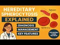 Hereditary Spherocytosis Explained | Diagnosis, Management &amp; Key Features | Pediatric Case Review