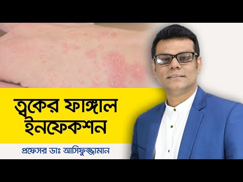 Skin fungal infection treatment - Skin fungal acne - Skin care bangla - Health Tips Bangla