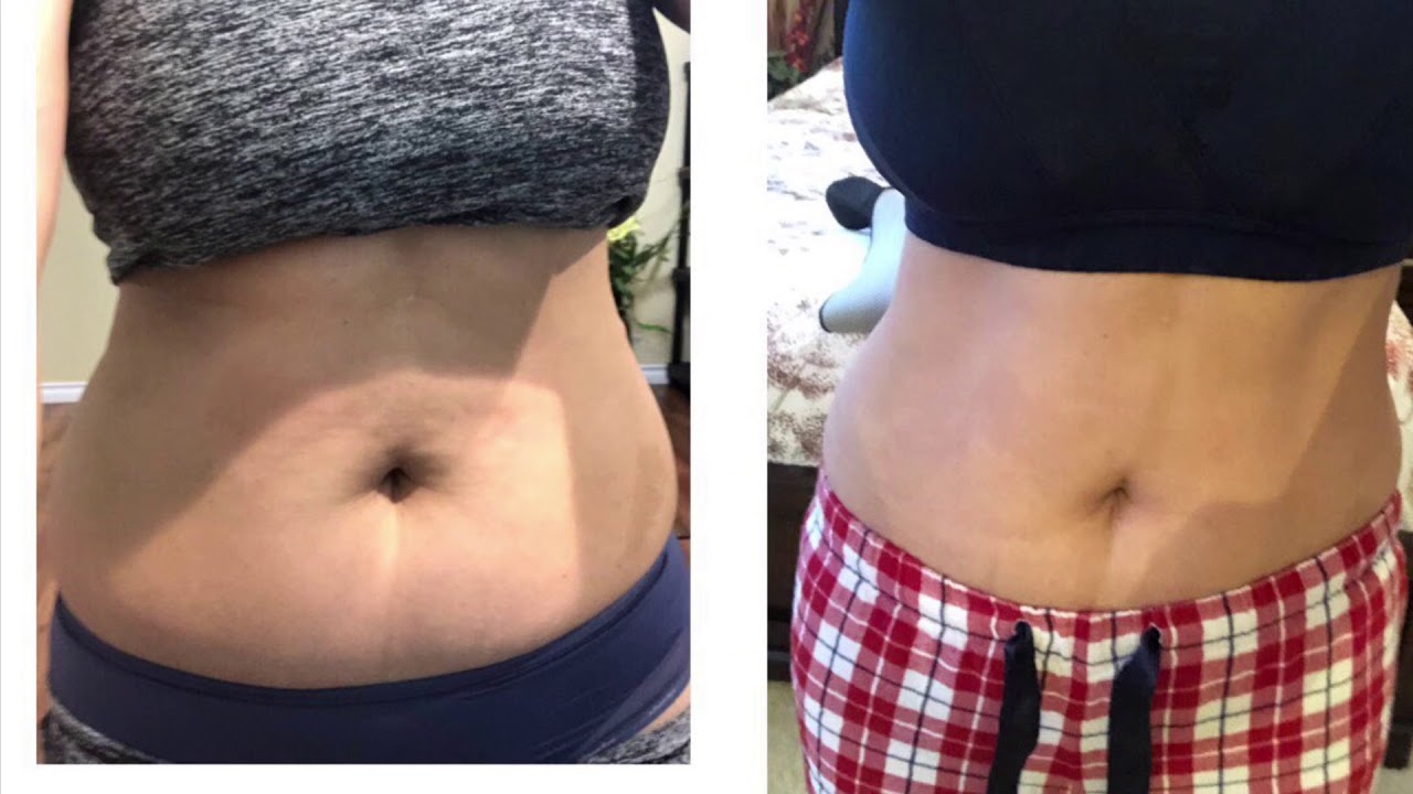 Caroline Girvan's Epic ll My one month home workout journey result