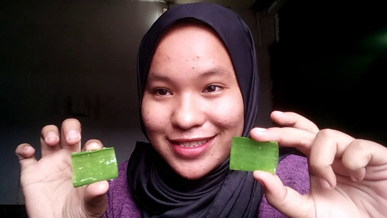 CARA MENGHILANGKAN JERAWAT PAKE LIDAH BUAYA 