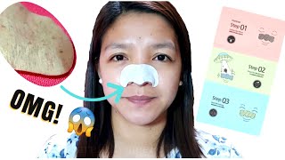 3- STEP BLACKHEAD REMOVAL STRIPS from MUMUSO | Blackheads Removal Strips
