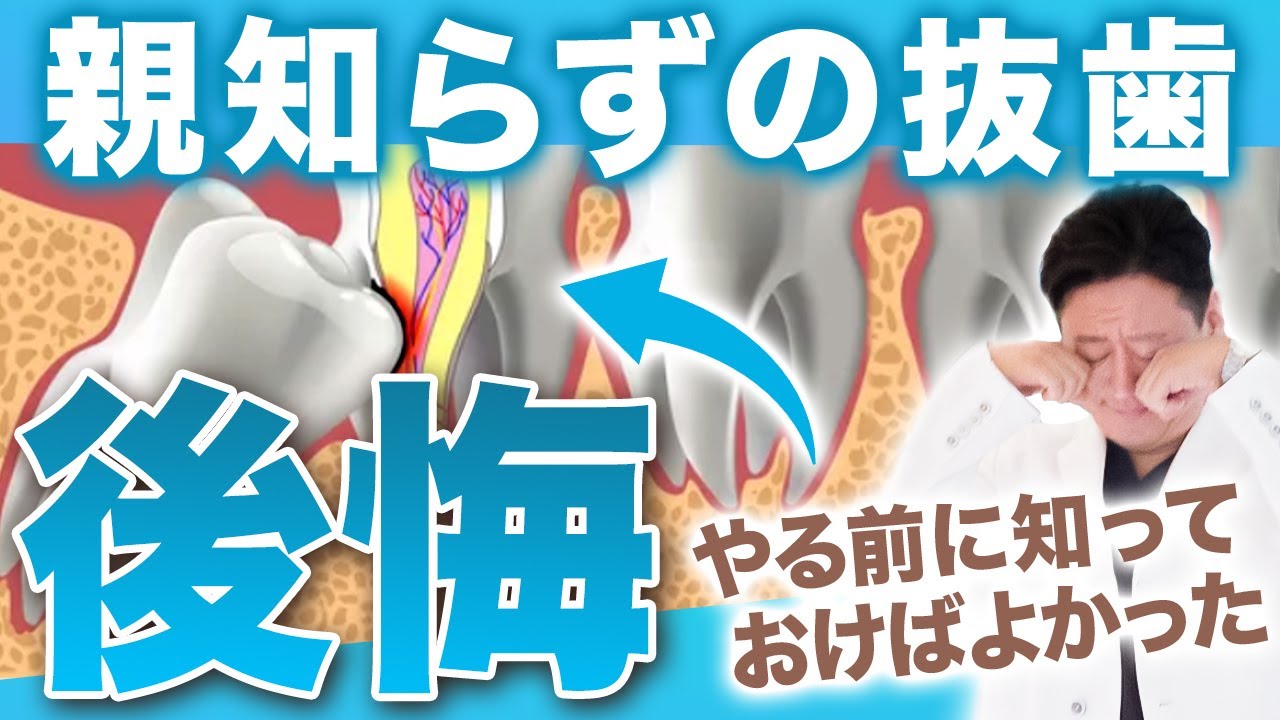 後悔する前に絶対見て！歯医者に聞けない親知らずの抜歯の不安や疑問を徹底解説！【審美歯科 歯列矯正 抜歯 親知らず】