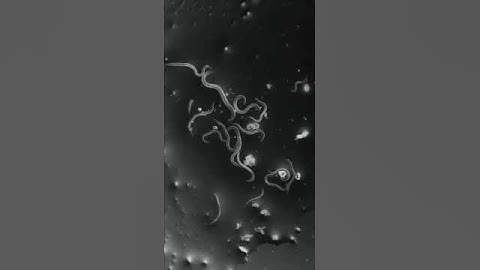 dust in our nail.#shortvideo #microscope #nails #germs #youtubeshorts