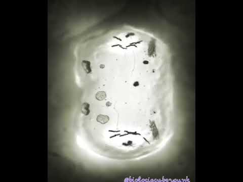 الانقسام الخلوي لاحظ الكروموسومات