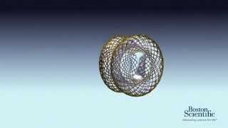 AXIOS™ Stent and Delivery System Animation