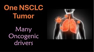Why 90% of Lung Cancer Drugs Fail — And How Omicue Closes the Gap