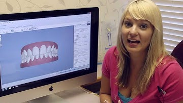 Invisalign Video Blog, My Virtual 3D Model (Clincheck) [HD] - Sierra 03