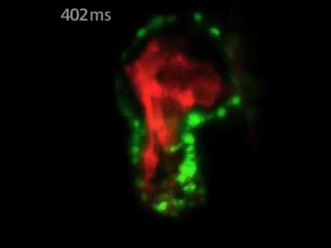 Video: Spon1b Modeļi: GFP Ekspresija Agrīnā Zebrafish Smadzeņu Attīstības Laikā