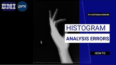 Understanding and Correcting Histogram Analysis Errors in Radiology
