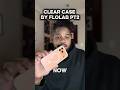 PT2! Honest review of the Flolab clear case!