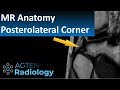 Ultimate guide to MR anatomy of the Posterolateral Corner in the Knee
