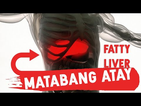 Video: Paano Alisin Ang Taba Ng Katawan