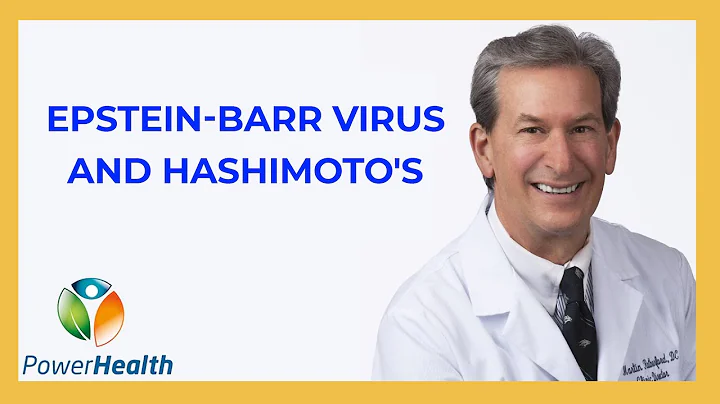 Epstein-Barr Virus and Hashimoto's