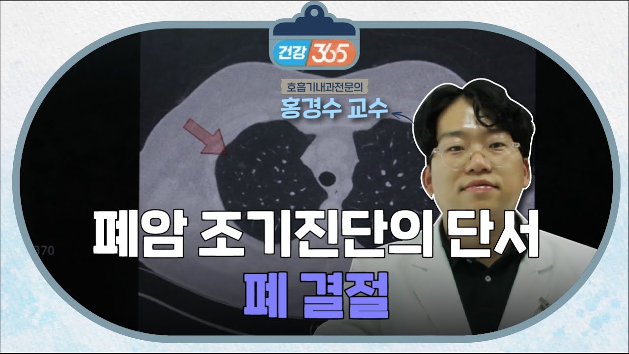 폐암 조기진단의 단서ㅣ폐 결절ㅣ홍경수 교수 [TBC클리닉건강365]