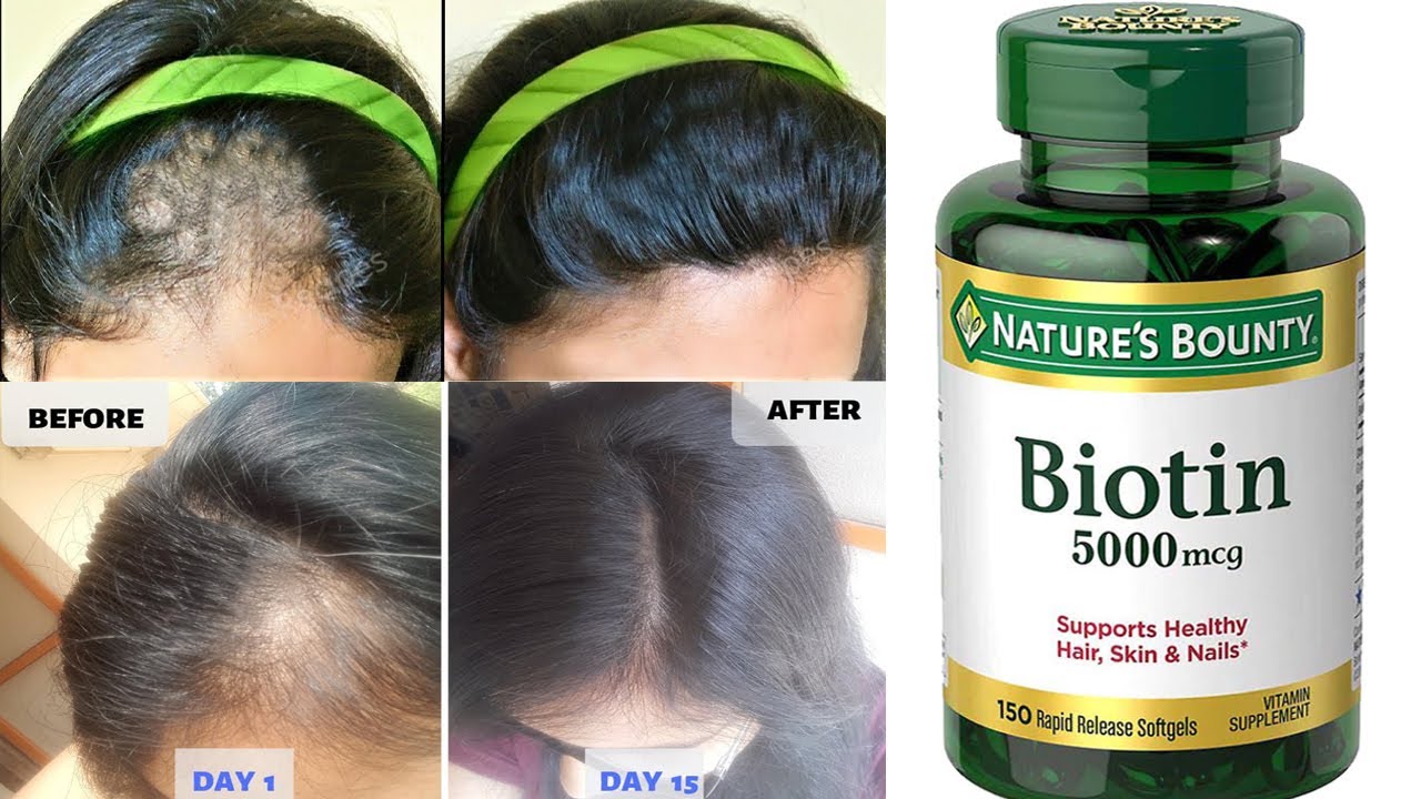 How To Stop Hair Fall and Grow long, thicken Hair with Biotin Hair