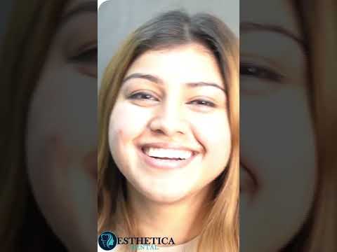Smile Designing make person confidence