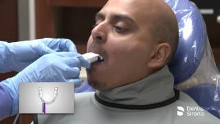 Snap-A-Ray-DS | Dentsply Sirona