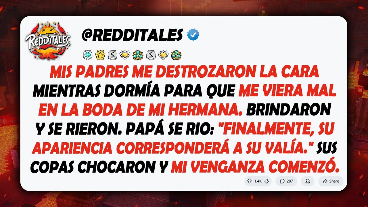 Mis padres me destrozaron la cara mientras dormía para que me viera mal en la boda de mi hermana...