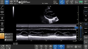 Venue™ Family R3 Tutorial - M-Mode