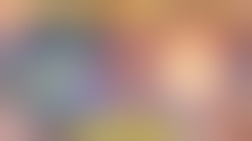 Cataract Vlog 6 - Phaco with Toric Lens - Dr Deepak Megur